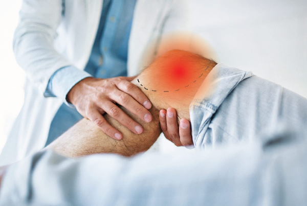 Partial Knee Replacement